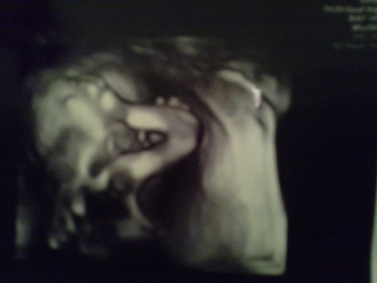 Узи 2 триместра!