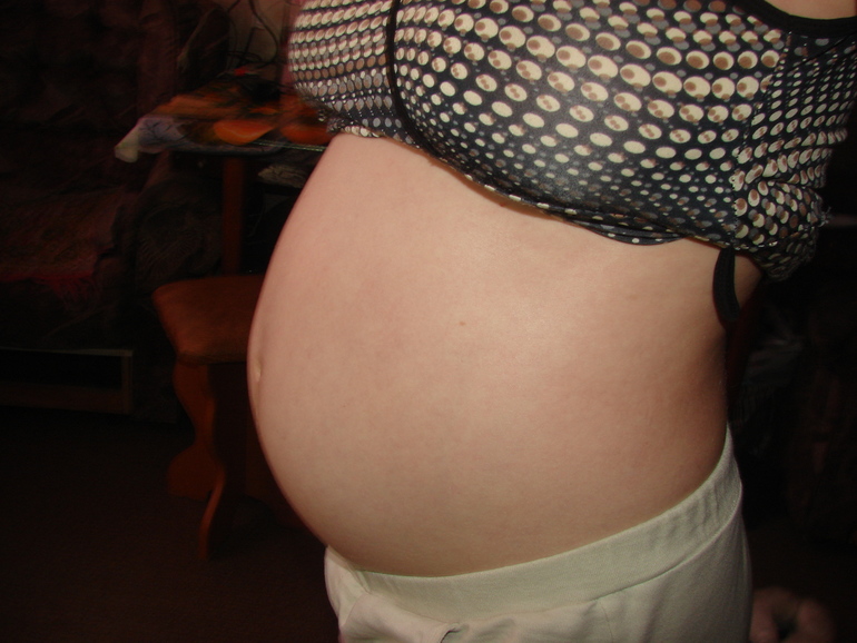 МОЙ ПУЗ)))20 неделек)))