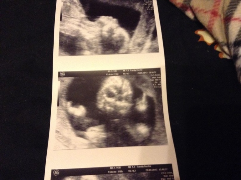 Весь в отца)))))