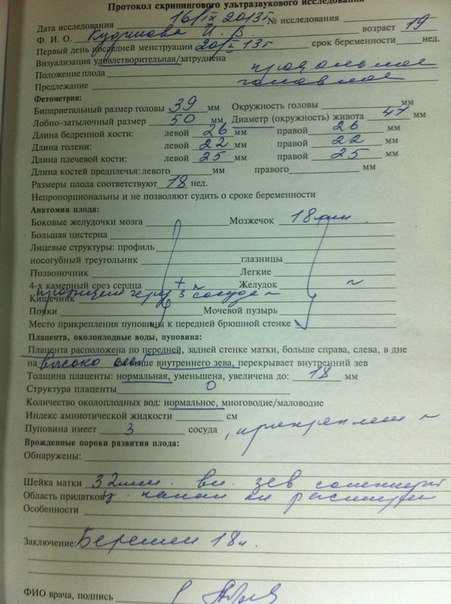 УЗИ 18 неделек