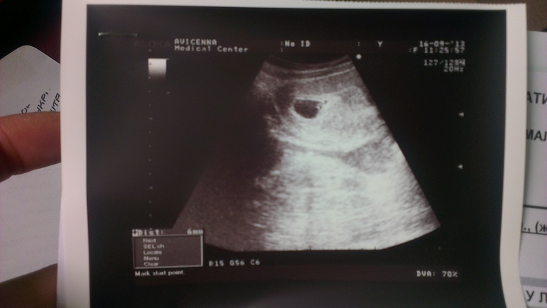 На конец-то!!!