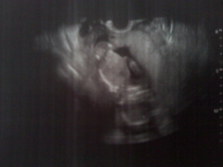 Сходила на узи!!!!