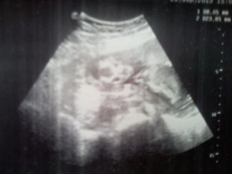 Сходила на узи!!!!