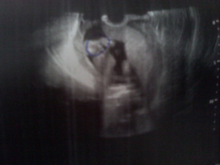 Сходила на узи!!!!