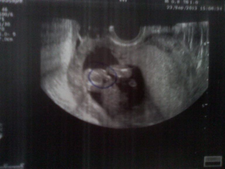 Сходила на узи!!!!