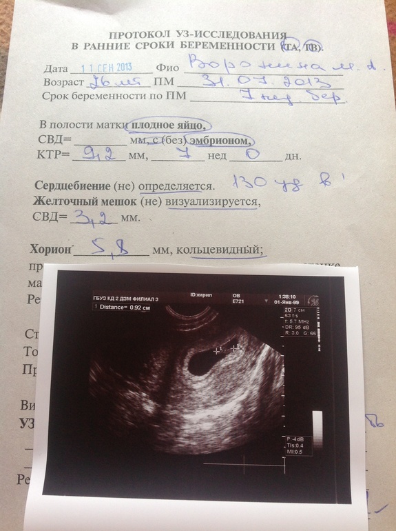 Сегодня были на УЗИ
