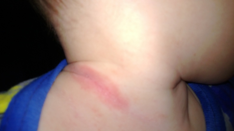 девочки,что это?и как с этим бороться?не проходит уже 4 месяца....