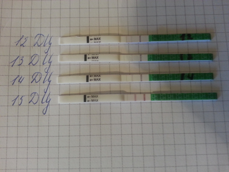 Овудиция ли это?