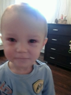 Конъюктивит(((