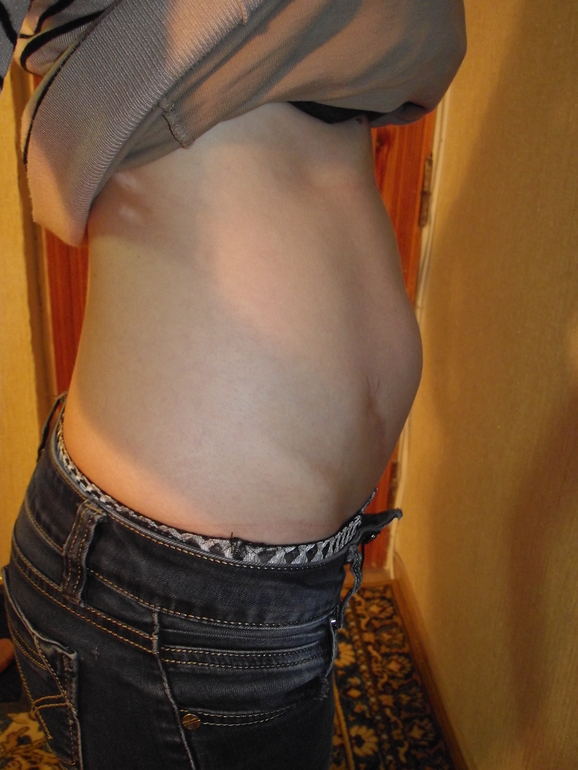 10 недель и 7 дней