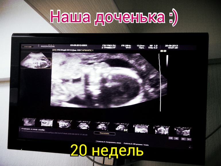 А у нас радостная новость: в моем животике растет наша ДОЧЕНЬКА:))))