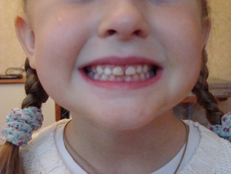 Благодарность