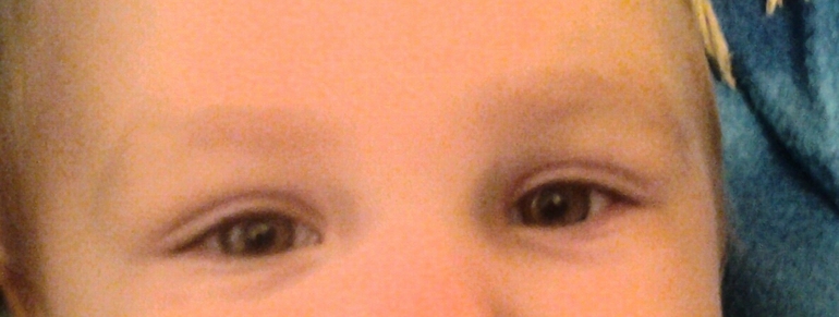 Синие возле глаз, у кого так было?