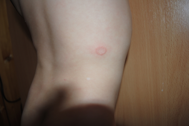 может было у кого такое?