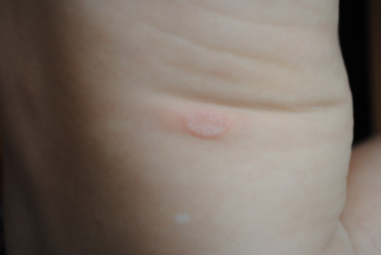 может было у кого такое?