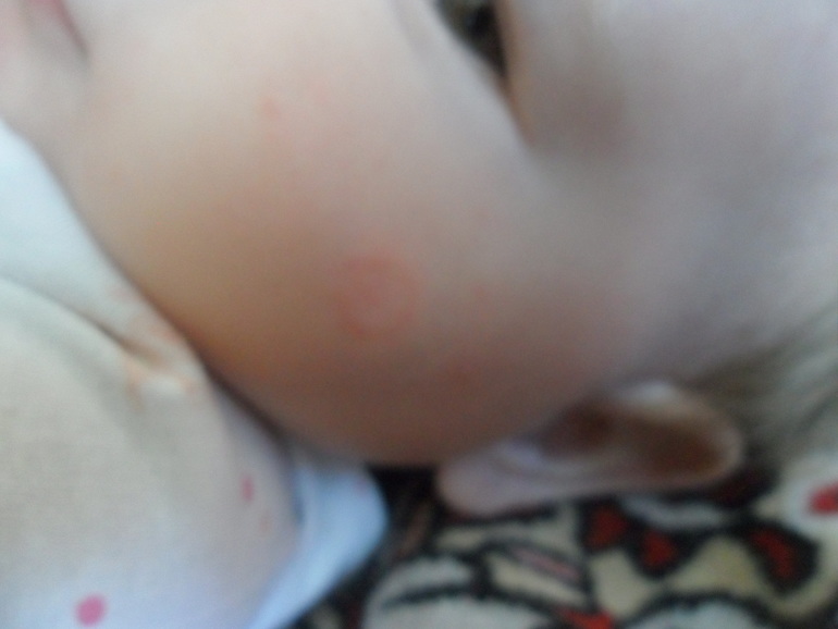 у дочи на лице