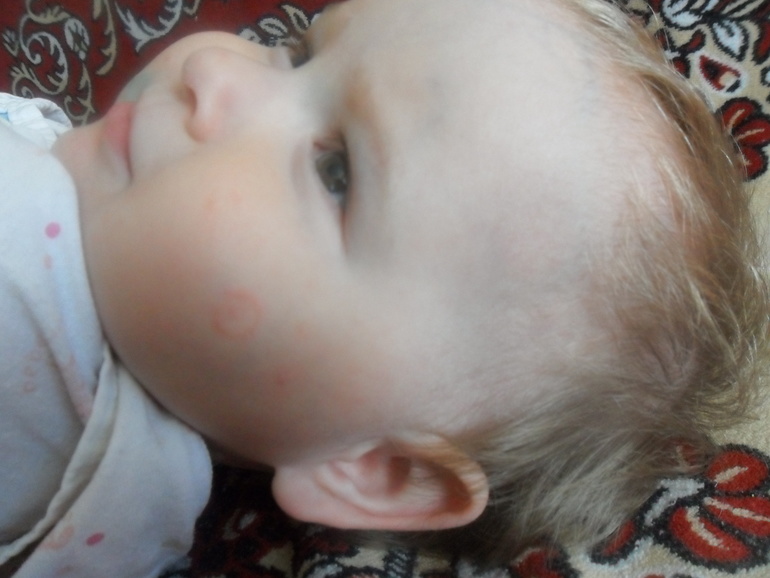 у дочи на лице