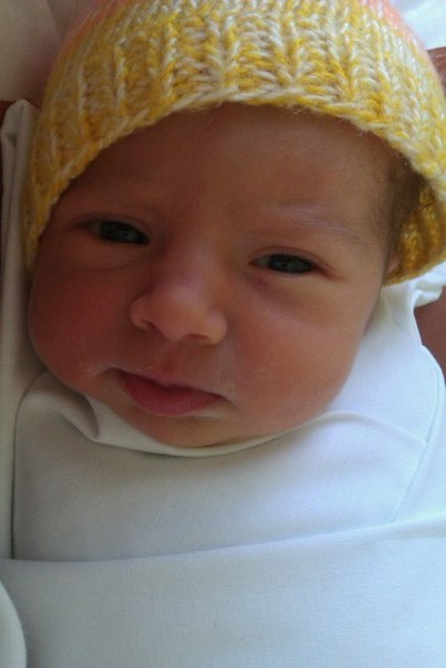 преждевременные роды на сроке 36 нед в 14 РД