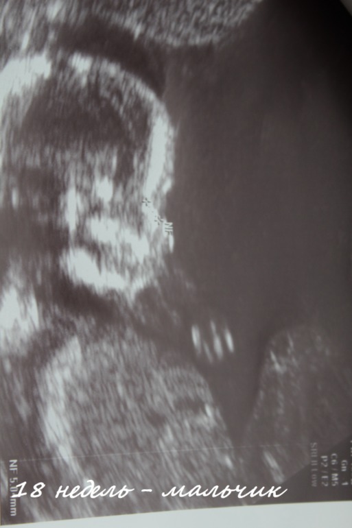 Наш пузорост 12 и 19 недель (много фоток +узи)