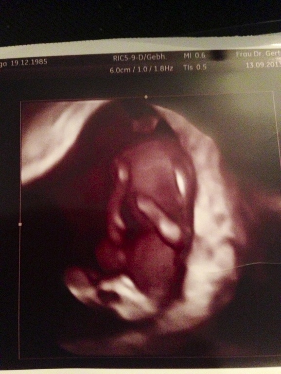 У нас танцор или танцовщица!