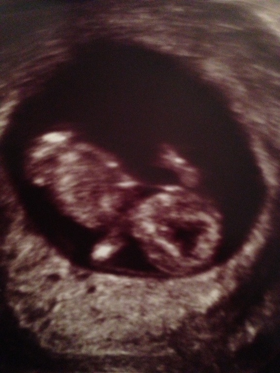 У нас танцор или танцовщица!