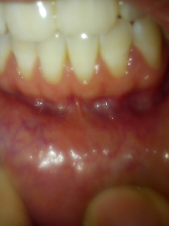 фото десен..как просили