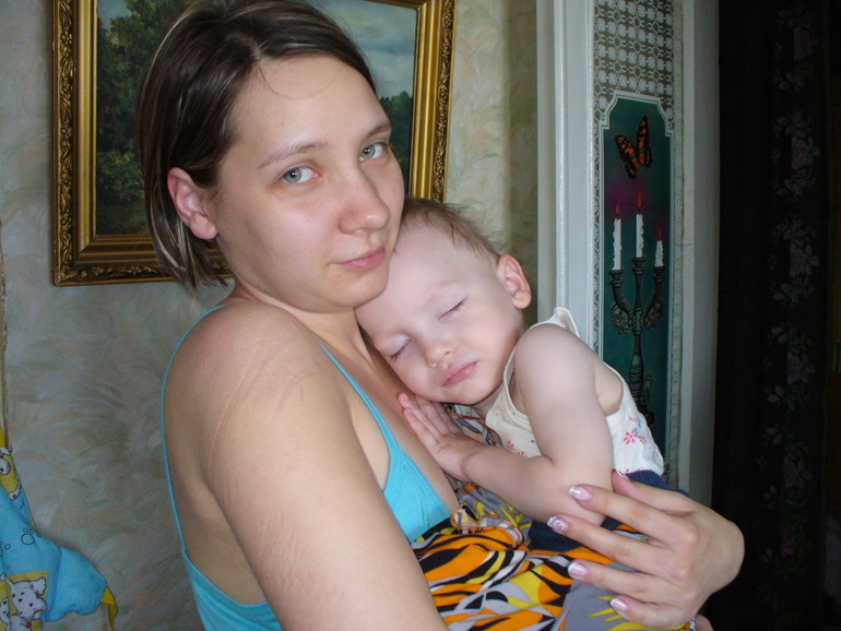 32-ая неделька и Сашулькино лечение)))