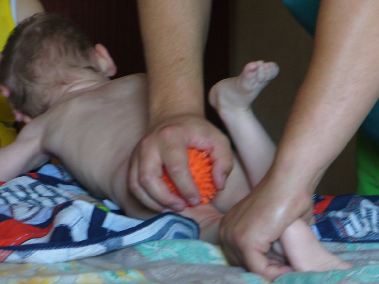 32-ая неделька и Сашулькино лечение)))