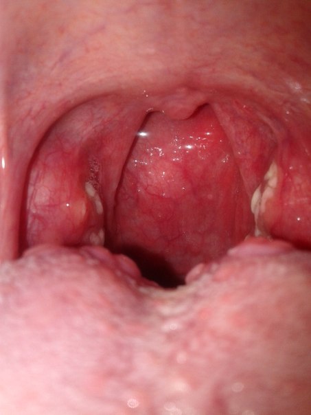 Ужасы нашего городка..