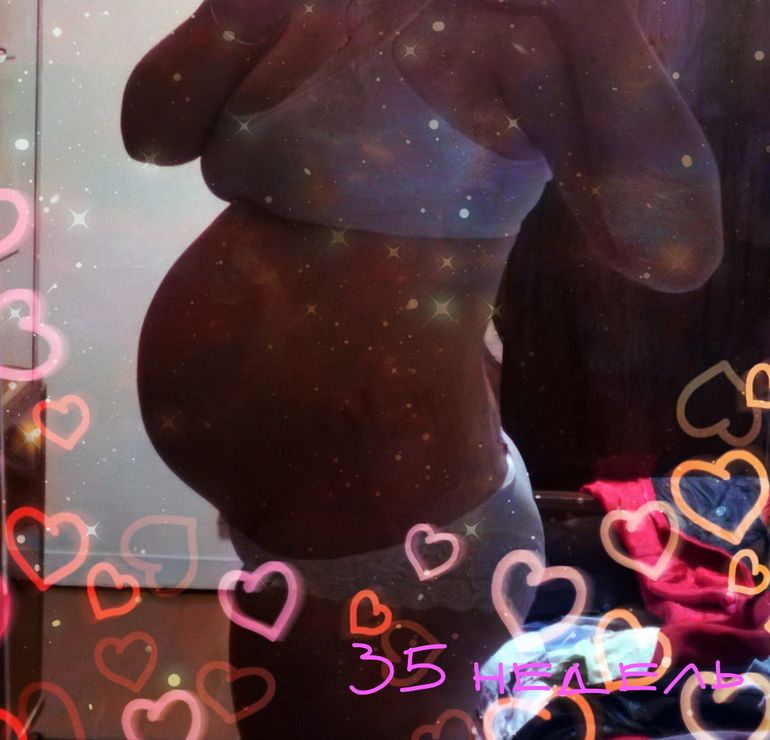 нам 35 недель