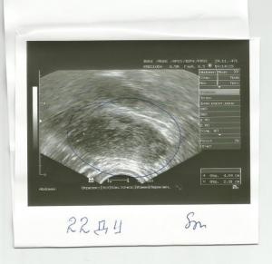 316204974941541aeb9f2959eea91136.jpg