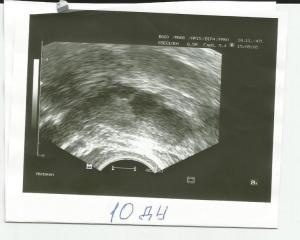 a370b22e0dda703fb5d67e526e87da81.jpg