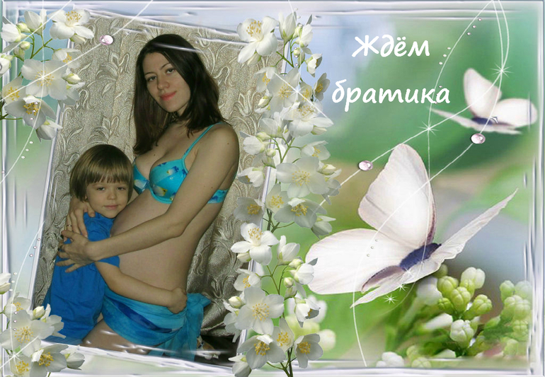 УЗИ