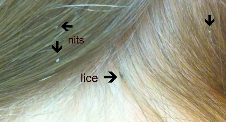 2bec56df50c8d7ed81d6e189ed14c062.jpg
