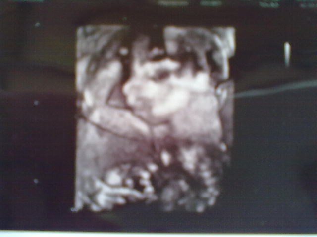 Мы узнали пол малыша)) у нас Дочка))