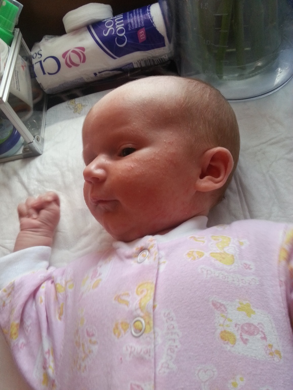 Девочки подскажите,у доченьки сыпь!!