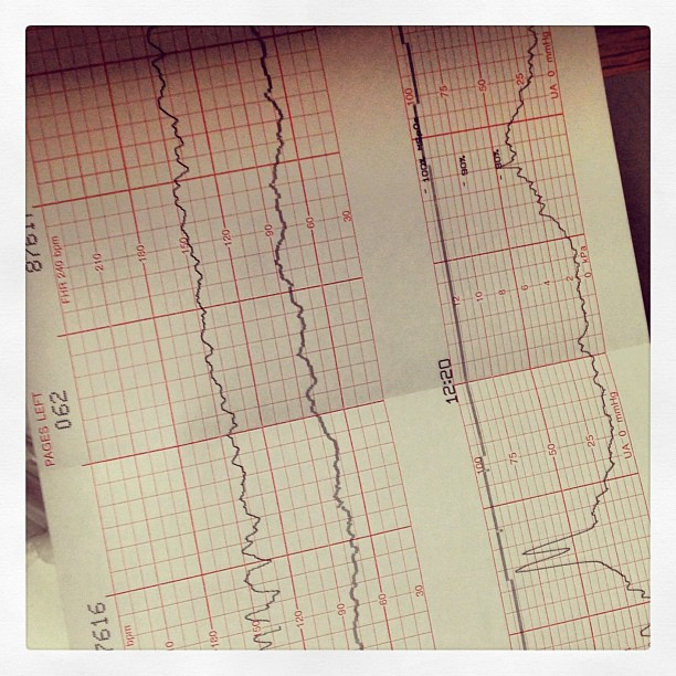 Роды.Часть первая!
