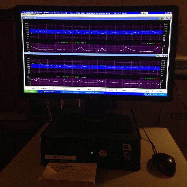 Роды.Часть первая!