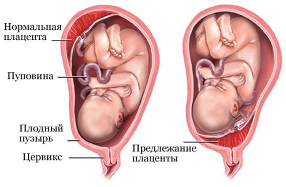 Лакуна вазорум стенки