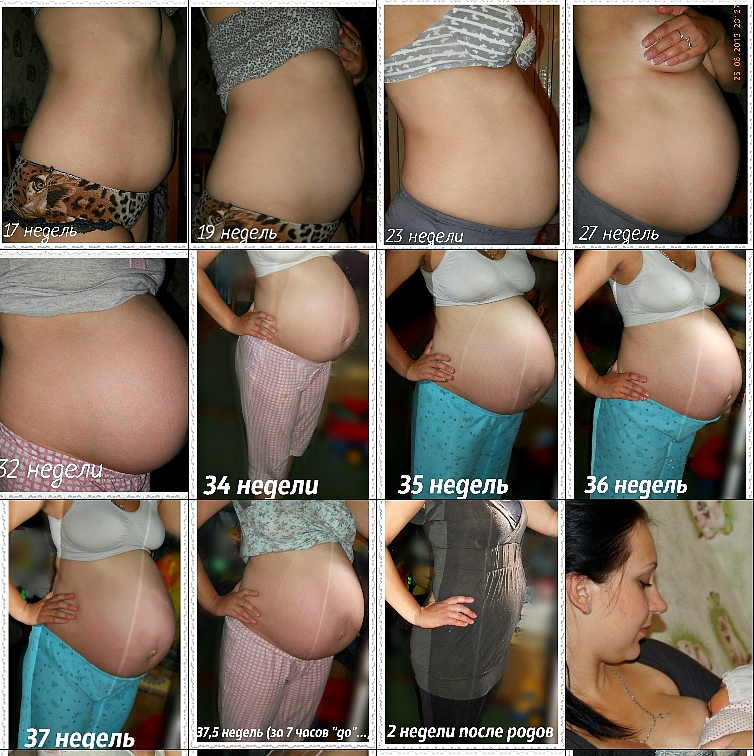 Так проходила моя третья беременность