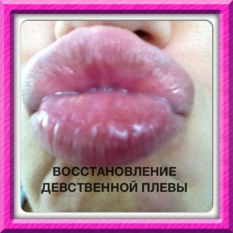 44e3d59b231b77429b43b792e62764f4.jpg