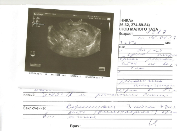 Беременные радости :)