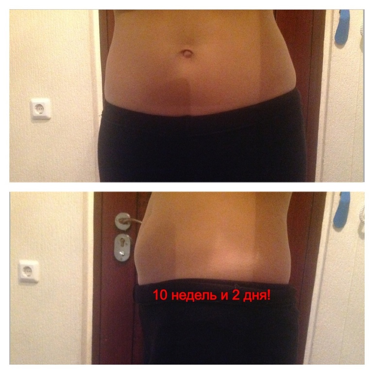 Фото пузика)