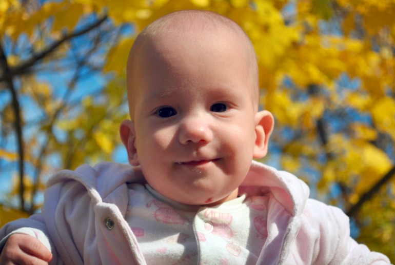 Гемангиома, наш опыт