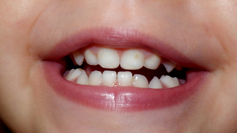 167ccfabd1610982e884378d2c6e820f.jpg