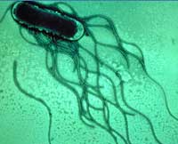 Сальмонеллез - ЧП республиканского маштаба