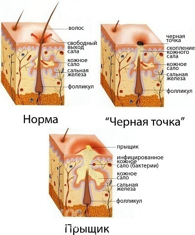 Статья по запросу: Милиумы Пикабу Дзен