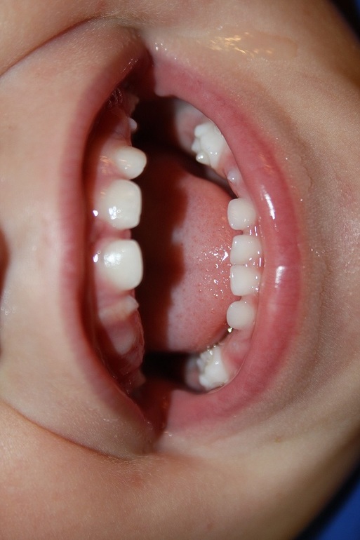 1 год 3 месяца