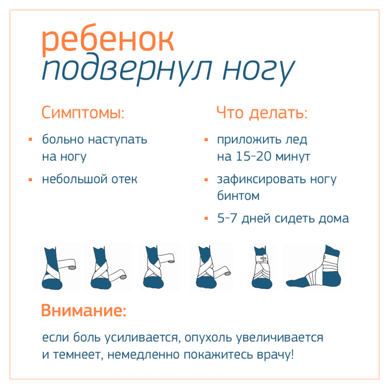 Нога на ногу что означает. Что делать если подвернулмеогу. Что делать если подвернул ногу. Что делать 5сом прлвернул ногу. Подвернула ногу что надо делать.