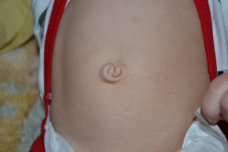 Про двойняшковые пупы ))
